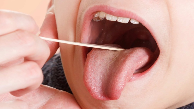 Mẫu dịch cổ họng dùng để làm các xét nghiệm chẩn đoán