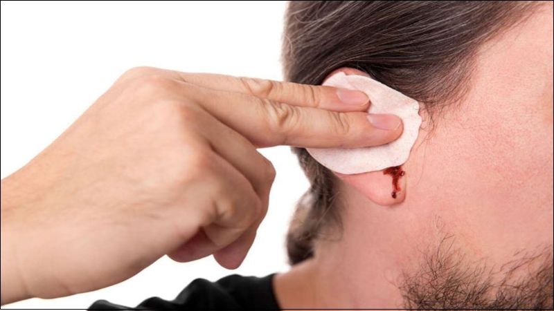 Bị chảy máu tai là bệnh gì? 6 nguyên nhân chảy máu tai bạn nên biết