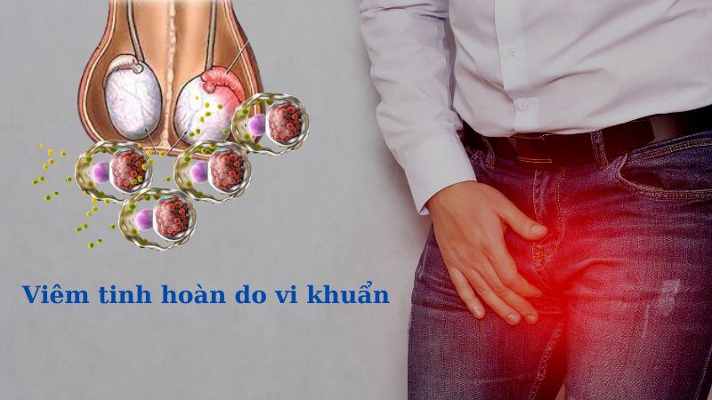 Viêm tinh hoàn do nhiễm khuẩn