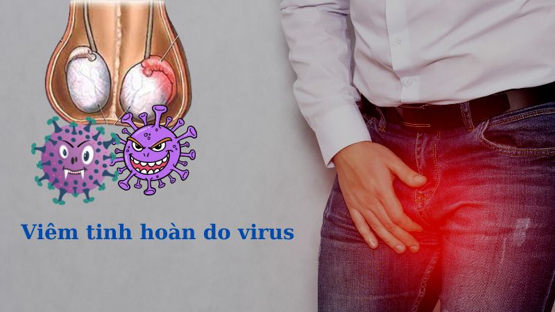 Viêm tinh hoàn do virus