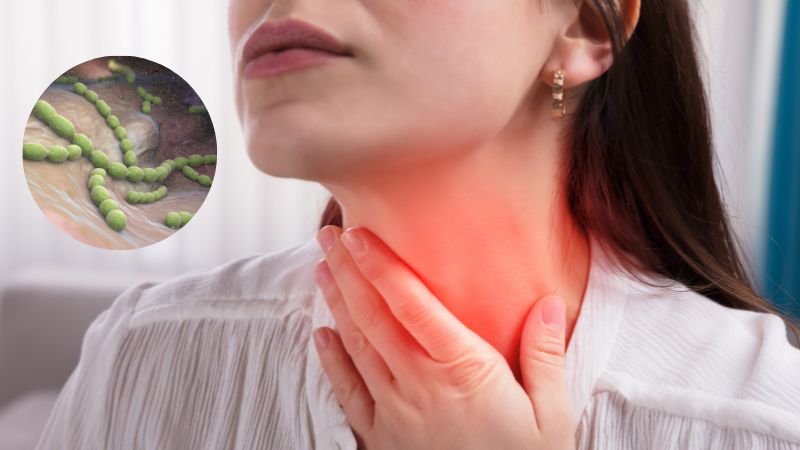 Viêm họng do liên cầu là một bệnh nhiễm trùng nhẹ, nhưng nó có thể làm cổ họng bạn rất đau