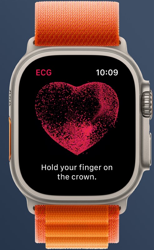 Hình ảnh cảm biến đo nhịp tim trên Apple Watch Hình ảnh cảm biến đo nhịp tim trên Apple Watch