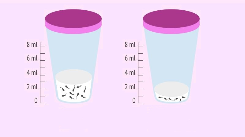 Thể tích tinh dịch bình thường (bên trái) và thể tích tinh dịch thấp (bên phải)