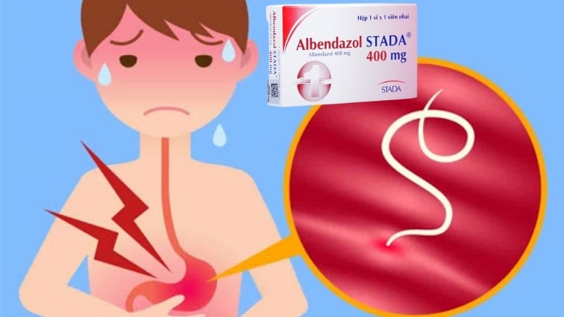 Thuốc tẩy giun Albendazol: Công dụng, cách dùng và lưu ý khi uống