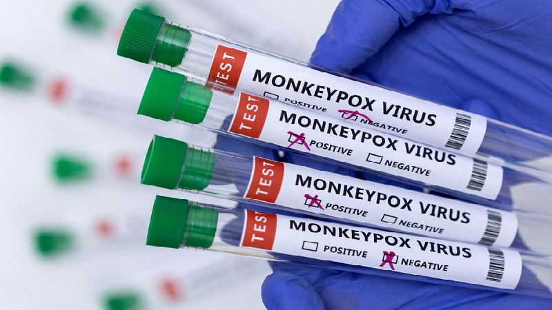 Test PCR để chẩn đoán xác định đậu mùa khỉ