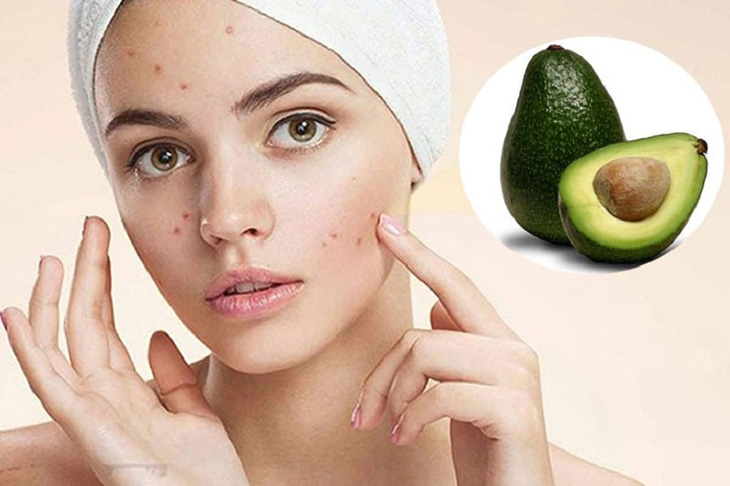 Sulfur ointment also has the ability to reduce acne scars