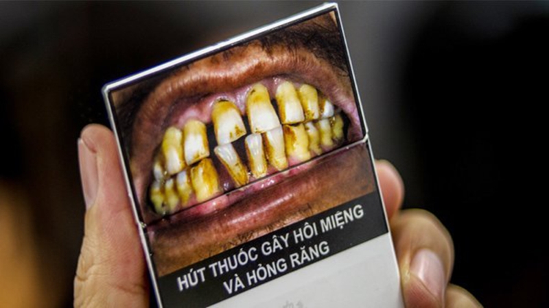 Bao bì thuốc lá phản ánh đúng thực trạng răng miệng của người nghiện thuốc lá
