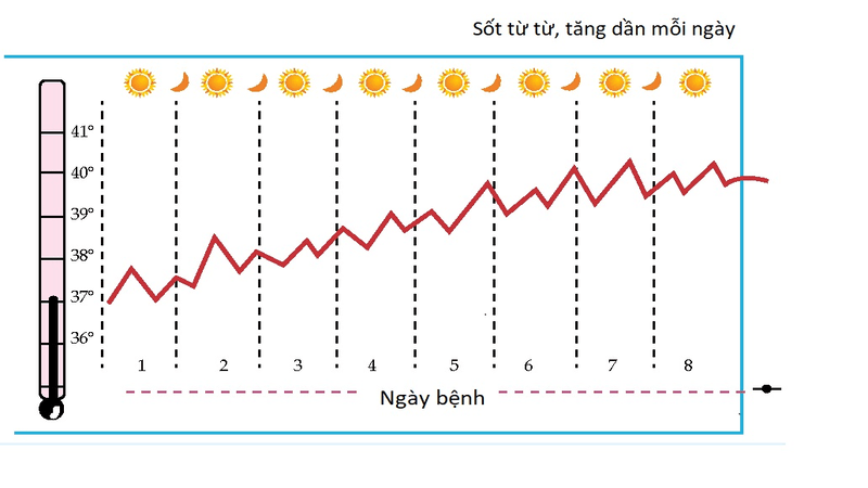 Sốt cao thường xuất hiện đột ngột và có mô hình "bậc thang"