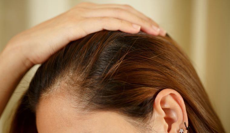 Những thói quen này khiến da đầu dễ có mùi hôi khó chịu 