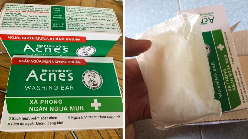 Xà phòng trị mụn lưng For Back Medicated Soap có tốt không?