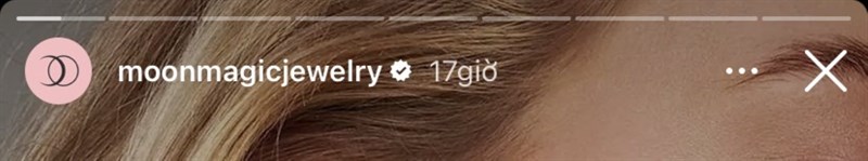 Bấm vào màn hình để bỏ qua Story nhiều lần gây ảnh hưởng tới trải nghiệm người dùng Bấm vào màn hình để bỏ qua Story nhiều lần gây ảnh hưởng tới trải nghiệm người dùng