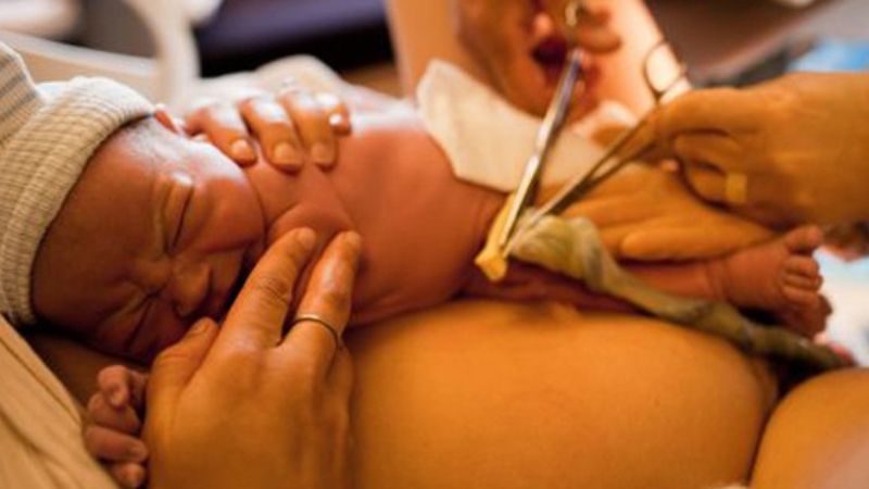 KẸP DÂY RỐN CHẬM MANG LẠI LỢI ÍCH CHO SỨC KHỎE SƠ SINH