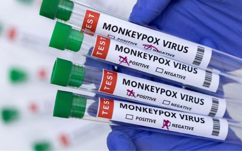 Xét nghiệm chẩn đoán xác định mẫu bệnh phẩm chứa vi rút đậu mùa khỉ