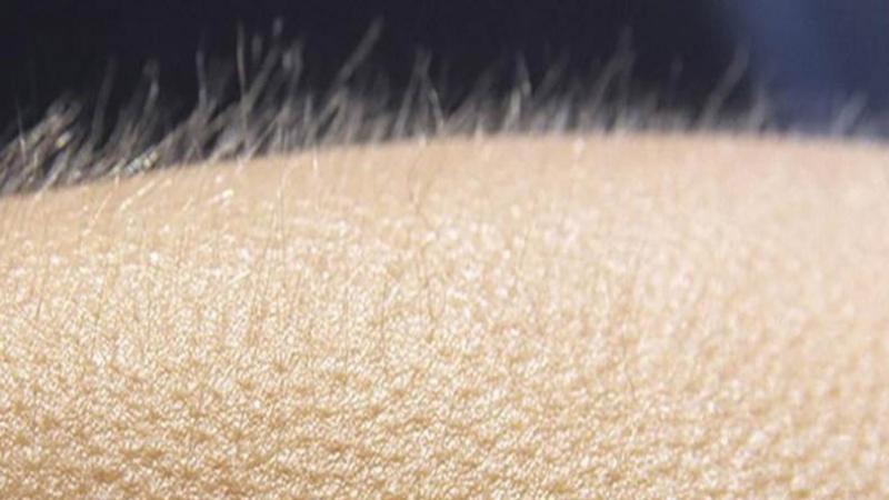 What is goosebumps (goosebumps)? Why do you often get goosebumps?