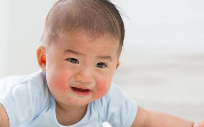 Nhận biết các dấu hiệu nhiễm trùng ở trẻ sinh sớm