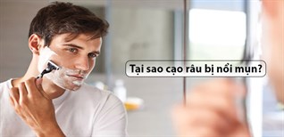 Tại sao cạo râu bị nổi mụn? 10 điều cần lưu ý khi cạo râu