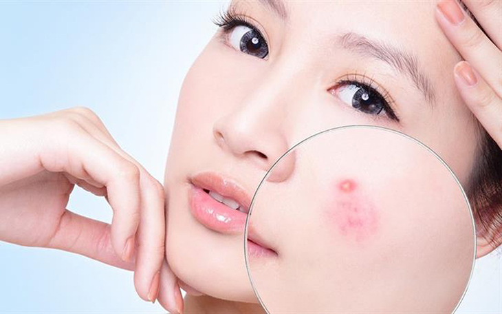 Rửa mặt bằng tay không làm sạch sâu da mặt, gây bí tắc lỗ chân lông