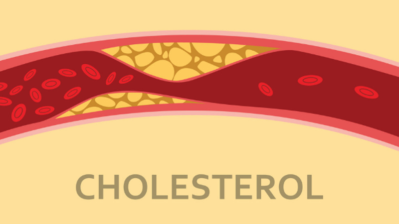 Cholesterol xấu là nguyên nhân gây các bệnh về tim mạch, mao lương hoa vàng giúp giảm cholesterol