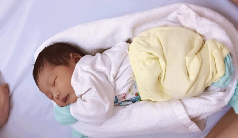 Nguyên nhân hội chứng đầu bẹt ở trẻ sơ sinh