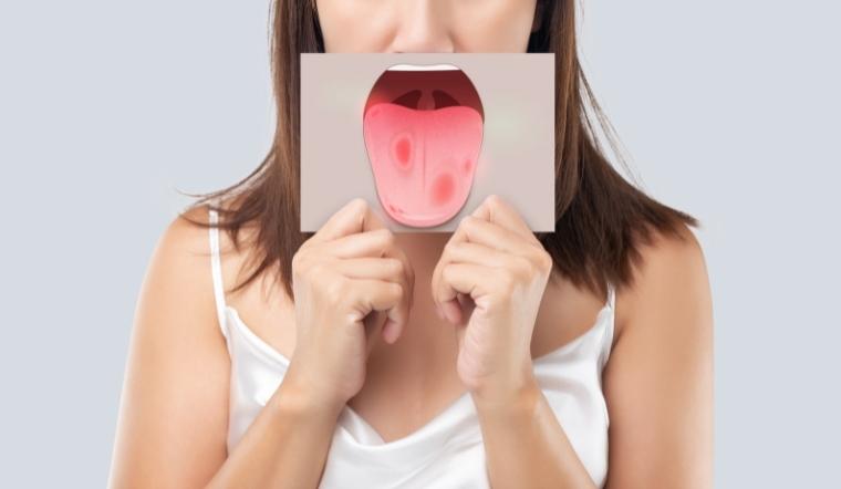 Miệng chua là bệnh gì? Nguyên nhân và cách khắc phục miệng chua