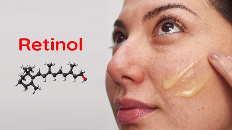 Retinoids giúp da giảm tiết dầu và thu nhỏ lỗ chân lông