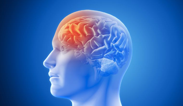 Gặp 5 hiện tượng này khi ngủ thì cần cảnh giác với bệnh nhồi máu não