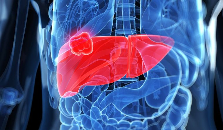 Cảnh báo nguy cơ bị ung thư gan với 3 biểu hiện lạ này khi ngủ