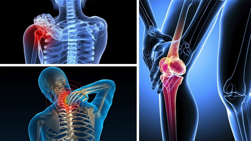 Thổ phục linh có mặt trong một số bài thuốc điều trị đau nhức xương khớp 