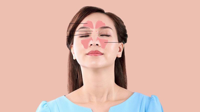 Các vấn đề mũi xoang