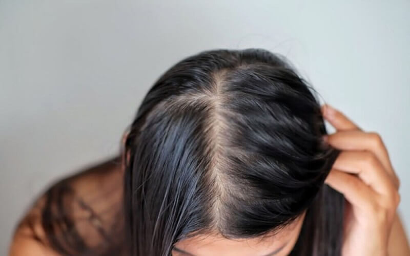 Oily hair should be washed with cold water, avoid touching the hair and rubbing it multiple times