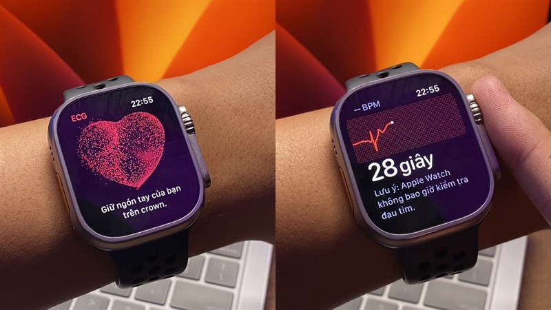 Cách đo điện tâm đồ với Apple Watch Ultra