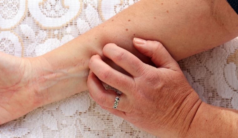 5 kiểu ngứa bất thường trên cơ thể cho thấy bệnh tiểu đường đang ẩn nấp