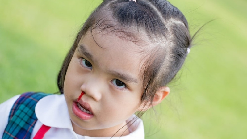 What are the causes of nosebleeds in children?
