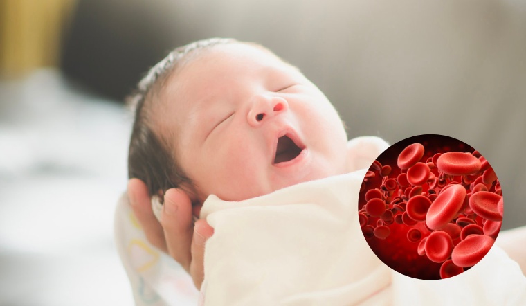 Tại sao trẻ sơ sinh bị rối loạn đông máu?