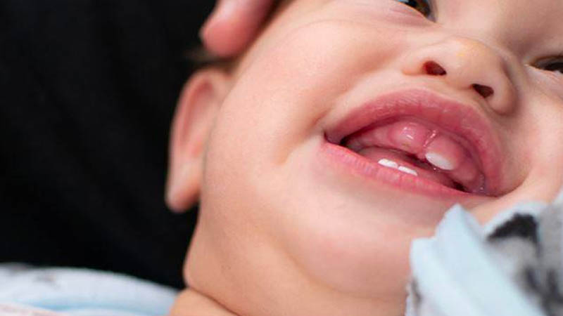 Trẻ mọc răng hàm dưới trước có nguy hiểm gì không?