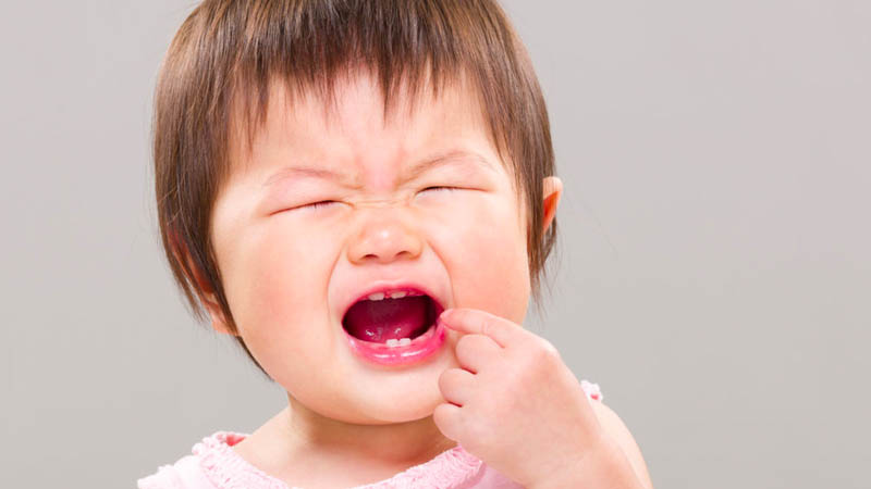 Nguyên nhân gây ra mọc răng không đúng thứ tự ở trẻ