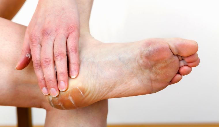 5 cách trị nứt gót chân sau khi sinh tại nhà hiệu quả cho mẹ bầu 