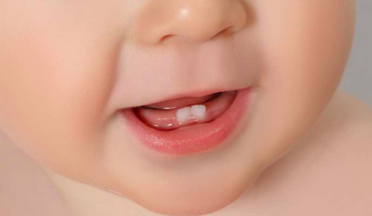 Những dấu hiệu nhận biết trẻ mọc thiếu răng sữa