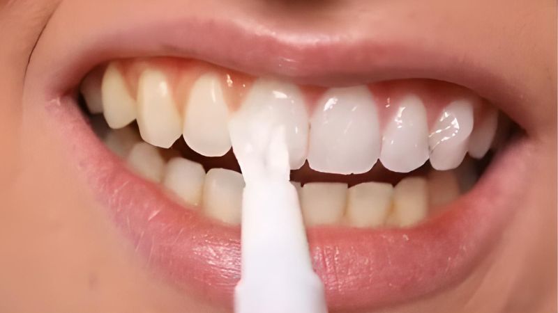 What is a teeth whitening pen? How to use teeth whitening pen safely?