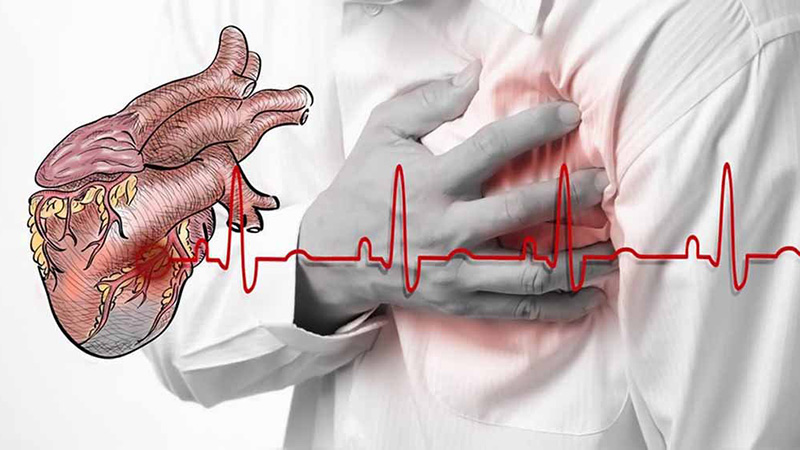 Nghiệm pháp Valsalva đối với rối loạn nhịp tim Bạn nên cẩn thận khi thực hiện nghiệm pháp Valsava nếu đang có các bệnh lý về tim mạch