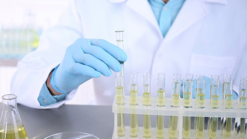 Xét nghiệm nước tiểu Bác sĩ có thể chỉ định cho bạn làm xét nghiệm nước tiểu để tìm tác nhân gây viêm bàng quang