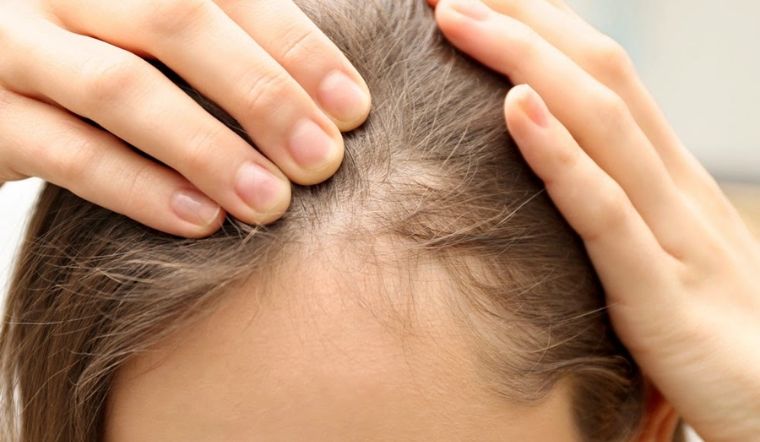 Tìm hiểu cách làm dầu ủ tóc trị hói từ vitamin B1 và dầu thầu dầu