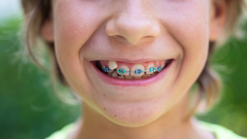 Loại bỏ các thói quen xấu về răng miệng