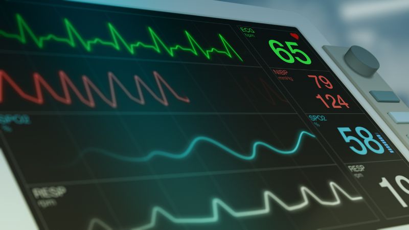 What is BPM in electrocardiogram? When should BPM be measured?