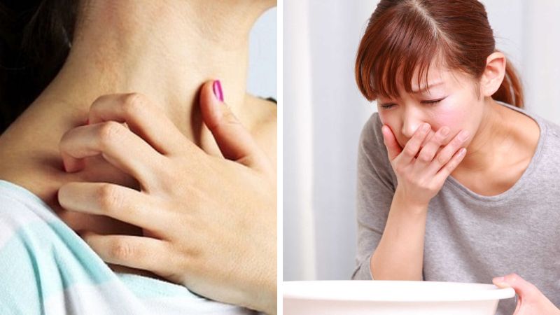 Ngứa khắp cơ thể và buồn nôn được xem là triệu chứng của dị ứng đậu nành