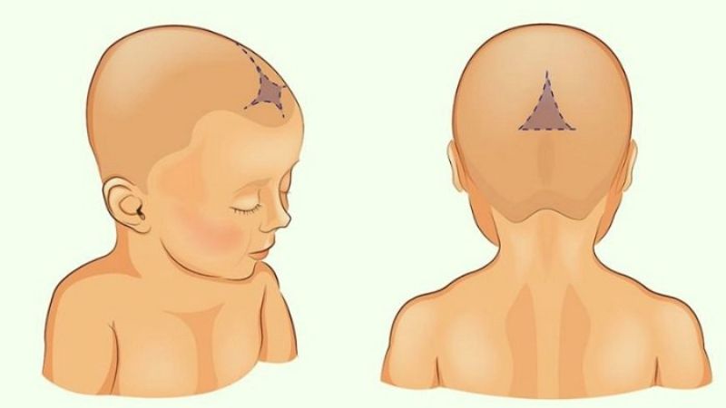 What is a newborn fontanel, how to safely examine the fontanelle in a newborn?