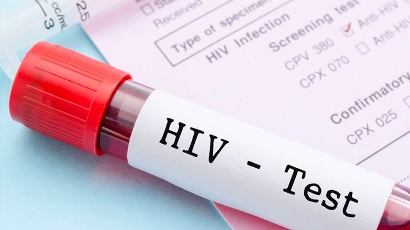 Kết quả từ que test HIV có độ chính xác khá cao