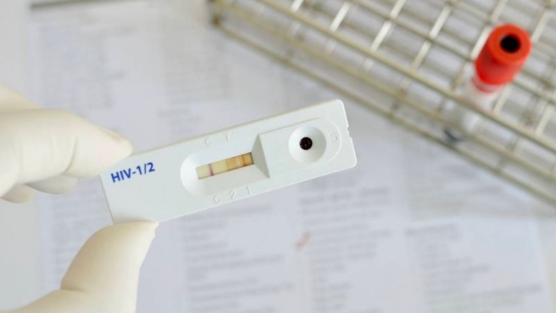 Các loại que test phổ biến dùng để xét nghiệm HIV tại nhà