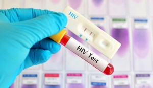 Cách xét nghiệm HIV tại nhà bằng que test HIV