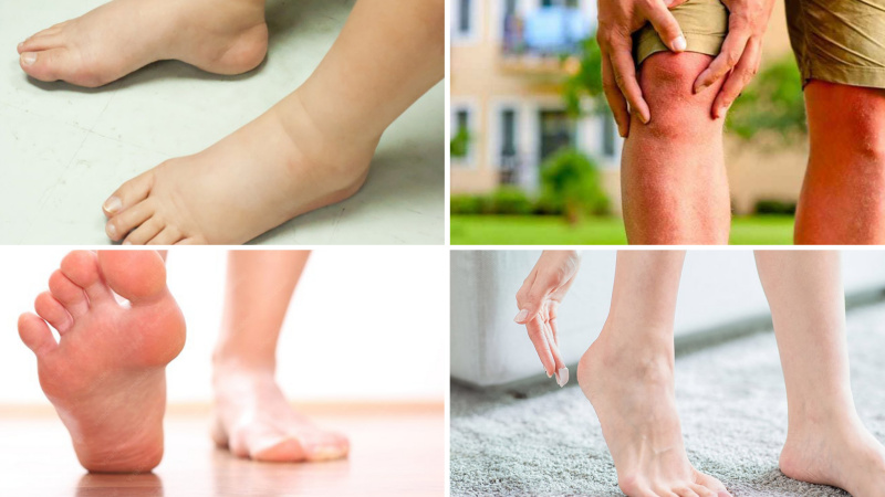 Phương pháp trị đau gót chân